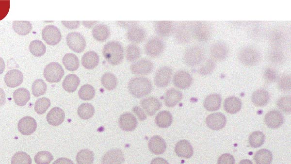 Voedingsmiddelen die je beter kunt vermijden om de bloedsomloop te bevorderen