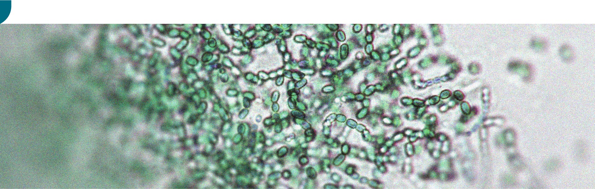 Es besteht ein Zusammenhang zwischen der Darmmikrobiota und körperlicher Aktivität