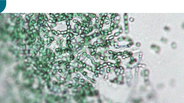 Existe uma relação entre a microbiota intestinal e a atividade física