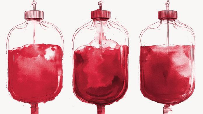 Voedingsmiddelen die je beter kunt vermijden om de bloedsomloop te bevorderen