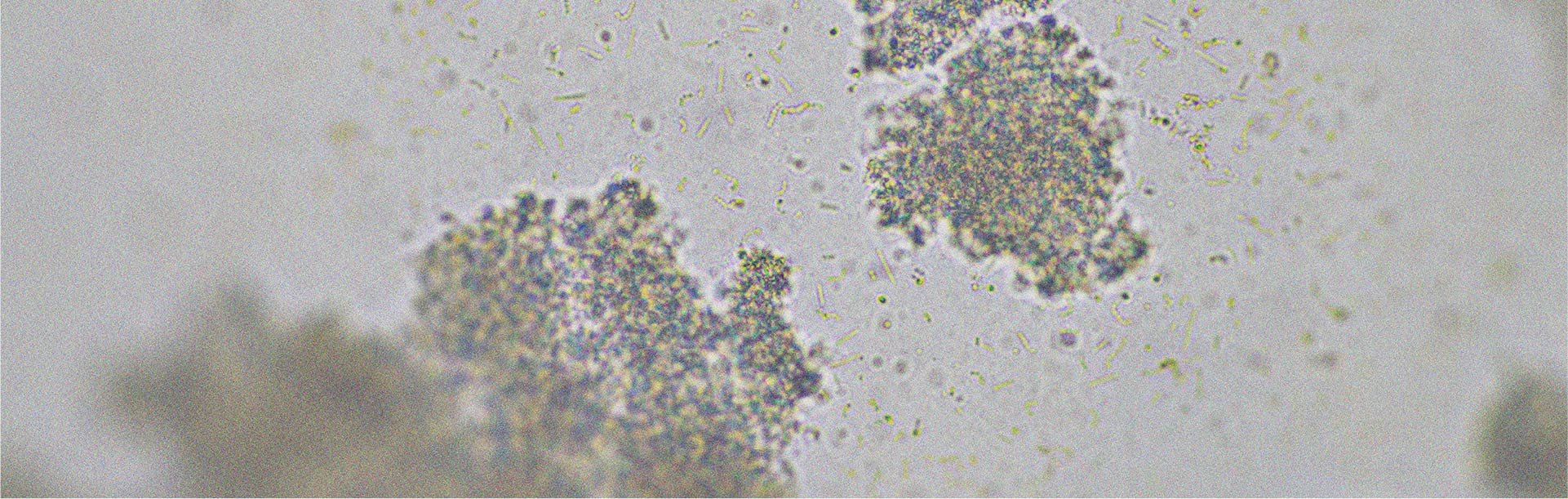 Ceppi probiotici che potrebbero aiutare ad alleviare la diarrea