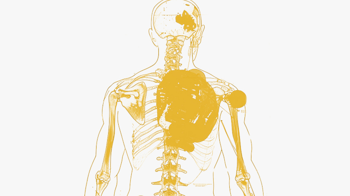 Pessoa que sofre de inflamação crónica