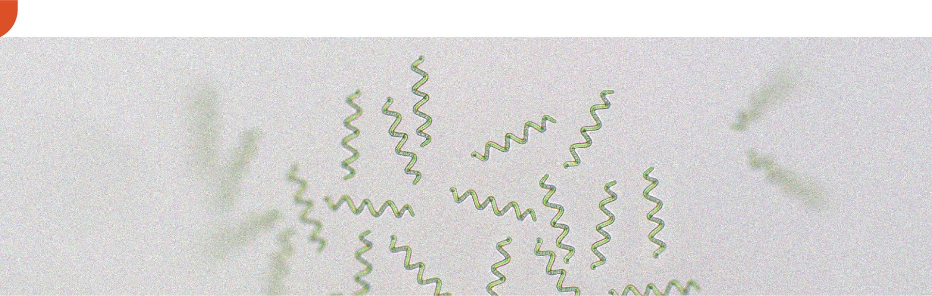 La espirulina podría ayudar a adelgazar