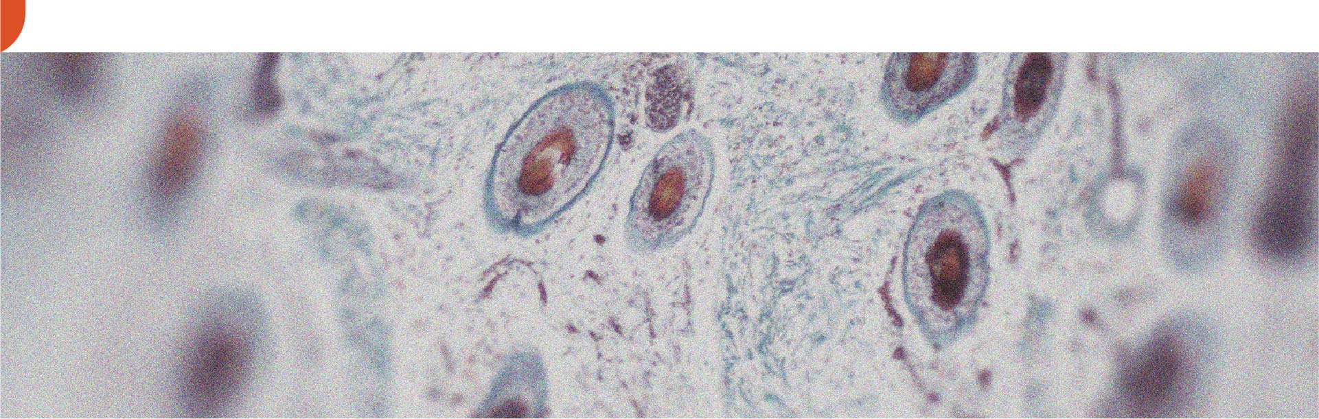 Auf welche Weise kann Vitamin A gut für die Haut sein?