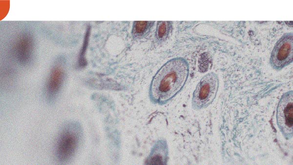 In che modo la vitamina A può essere benefica per la pelle?